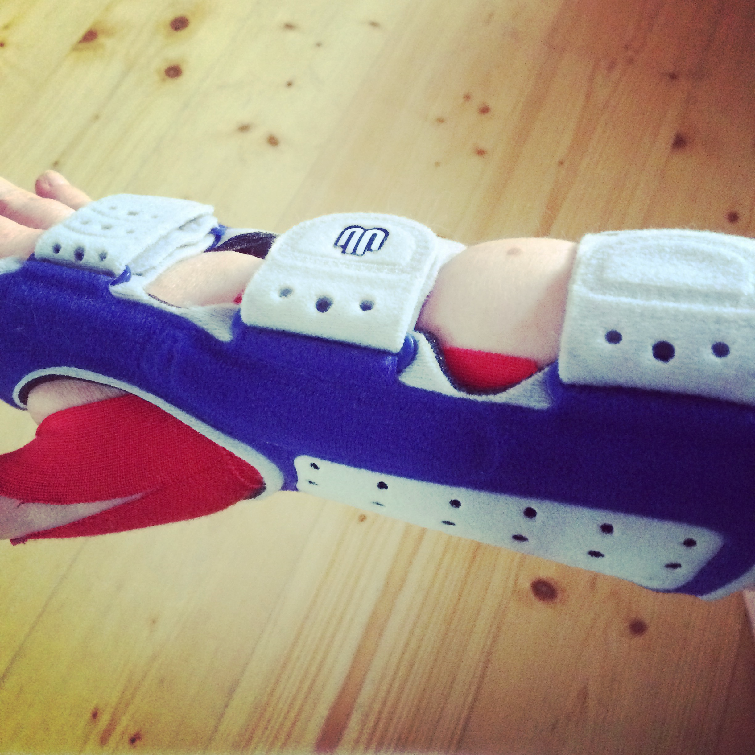 A taped wrist wearing a fabric covered metal brace - unable to hold a pen to write.