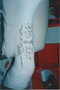 Broken leg in 1994